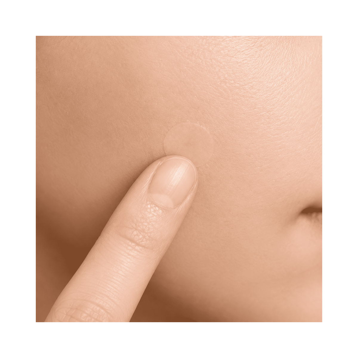 Skin1004 - Spot Cover Patch Ultra-thin Patches for Imperfections