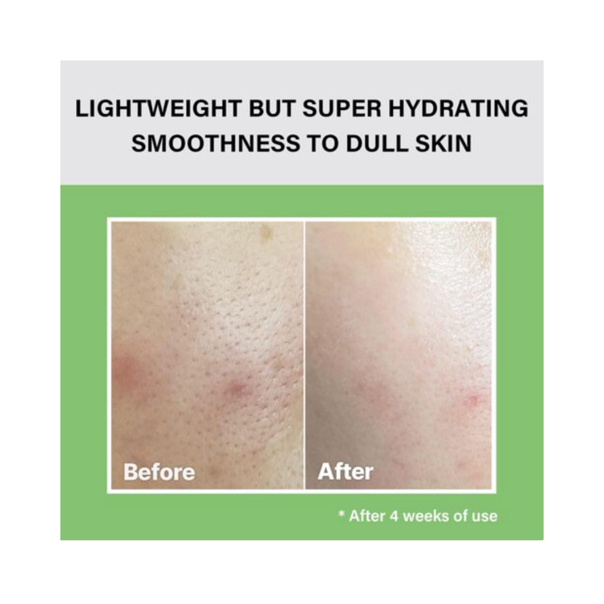 Celimax – The Real Noni Moisture Balancing Toner